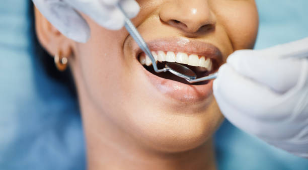 Best Emergency Tooth Extraction in Marina Del Rey, CA