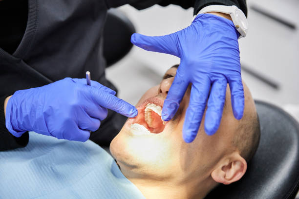 Best Pediatric Emergency Dentist in Marina Del Rey, CA
