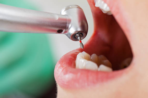 Best Emergency Denture Repair in Marina Del Rey, CA